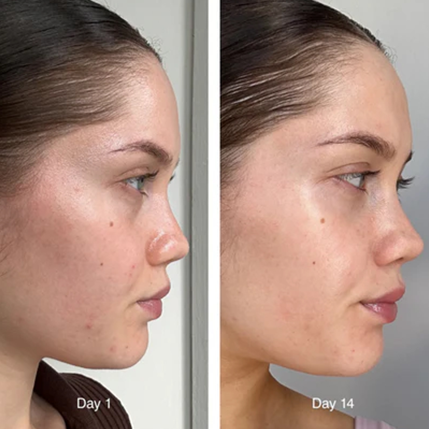ESSENZA VISO CERAMIDE AL LATTE VETRATA